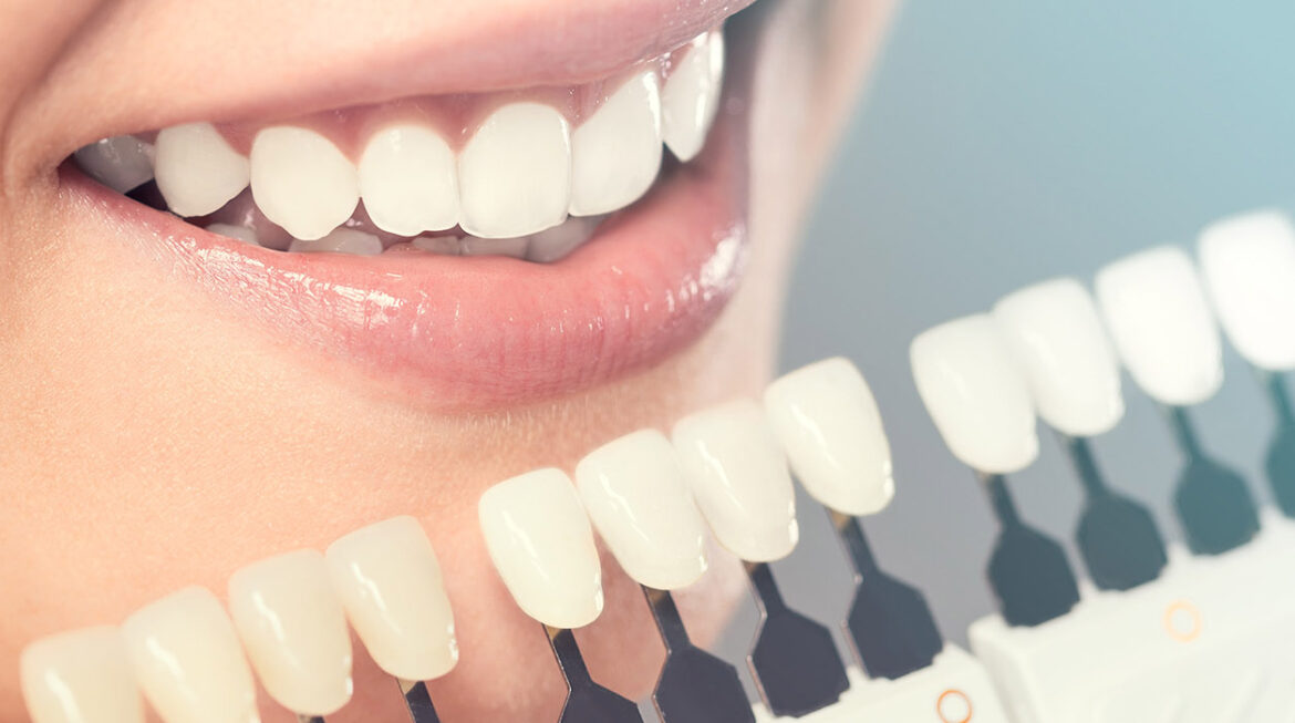Discover These 7 Types of Cosmetic Dentistry to Enhance Your Smile