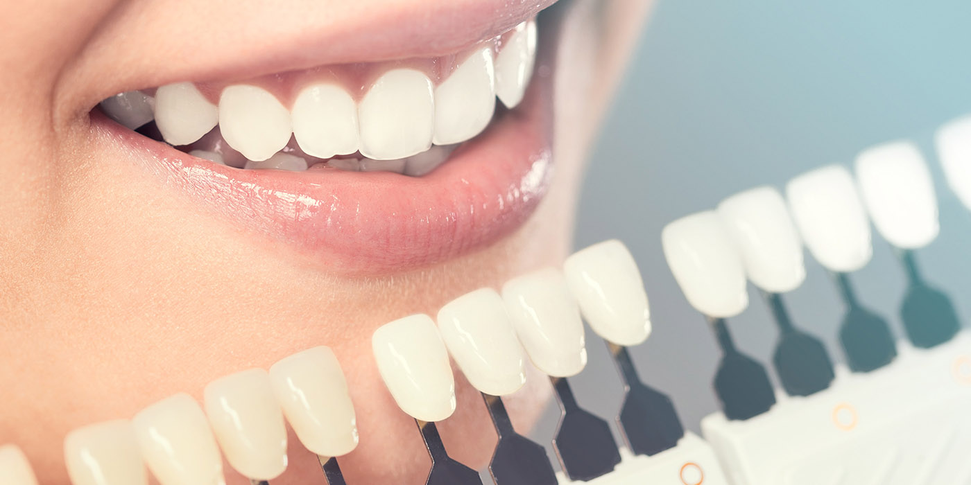 Discover These 7 Types of Cosmetic Dentistry to Enhance Your Smile